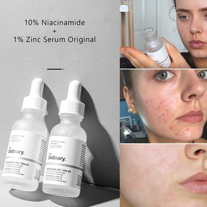 The Ordinary Niacinamide 10% + Zinc 1% Serum